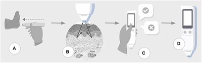 Gestational age assessed by optical skin reflection in low-birth-weight newborns: Applications in classification at birth